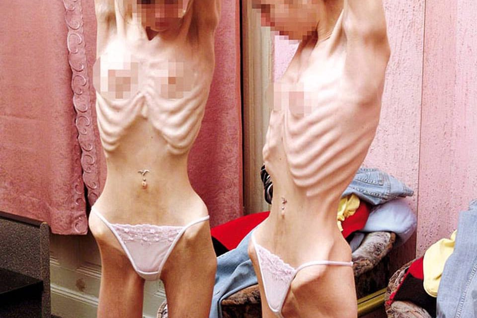 Shock, chiuso il blog che incitava le ragazze all'anoressia [FOTO]