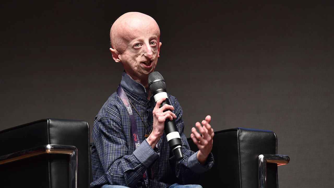 Addio a Sammy Basso, l’uomo che ha speso la propria vita per far conoscere la progeria